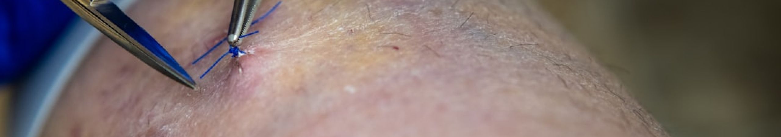 Keratin Treatments and Frizz Control 1 015245b3 Keratin Treatments and Frizz Control